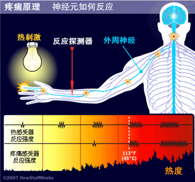 疼痛之轮WHEELOFPAIN-深入探索疼痛之轮：理解与应对身体的不适体验